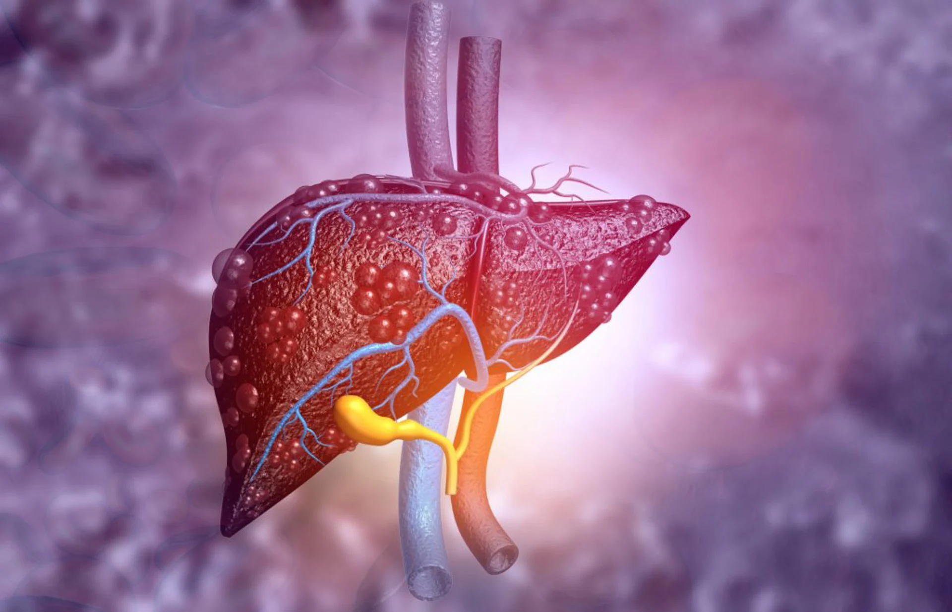 colangitis_biliar_Imagen_destacada