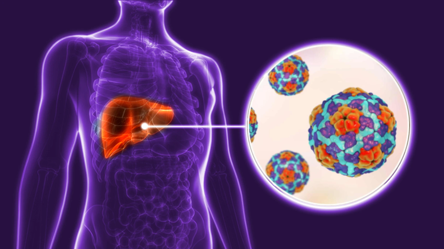 hepatitis_A_imagen_destacada
